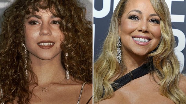 10 célébrités avant/après quelques années : gros changements !