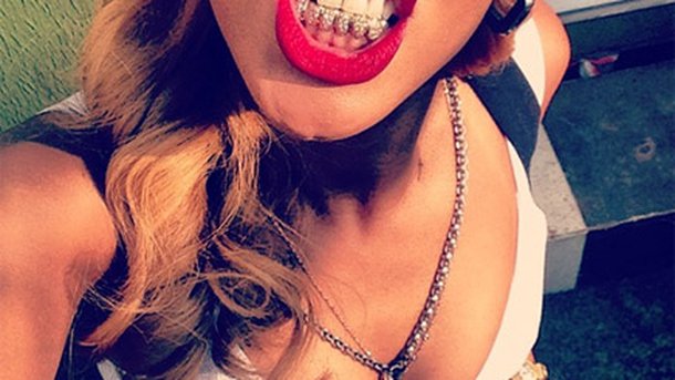 Rihanna, Beyonce, Lady Gaga : les stars adoptent les dents en or !