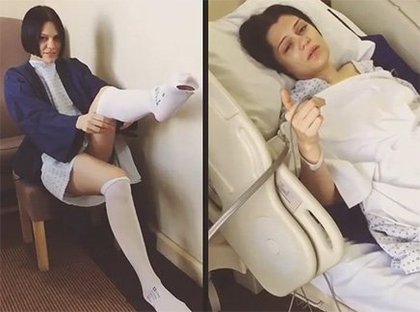 Jessie J