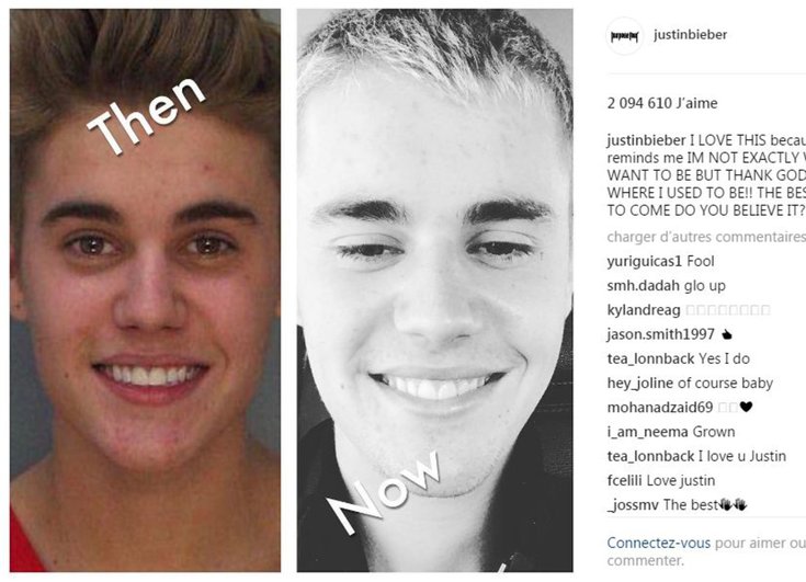Justin Bieber