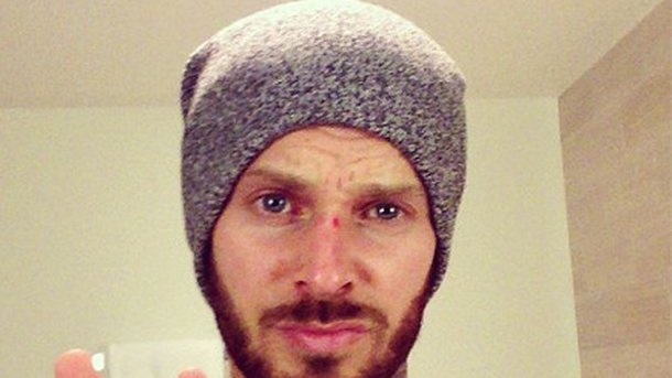 M. Pokora : blessé à New York !