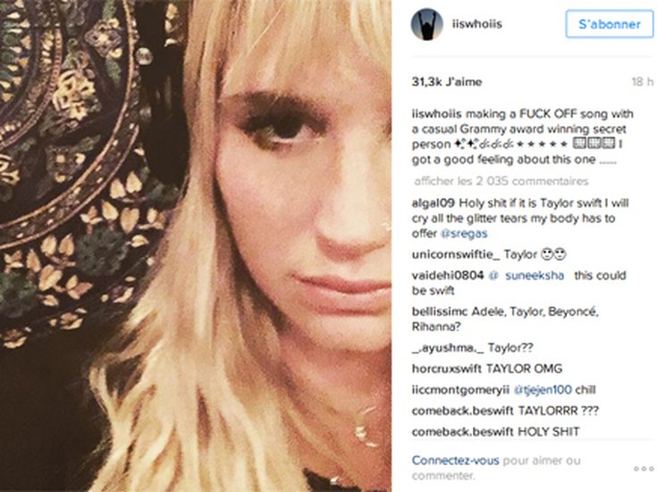 Kesha