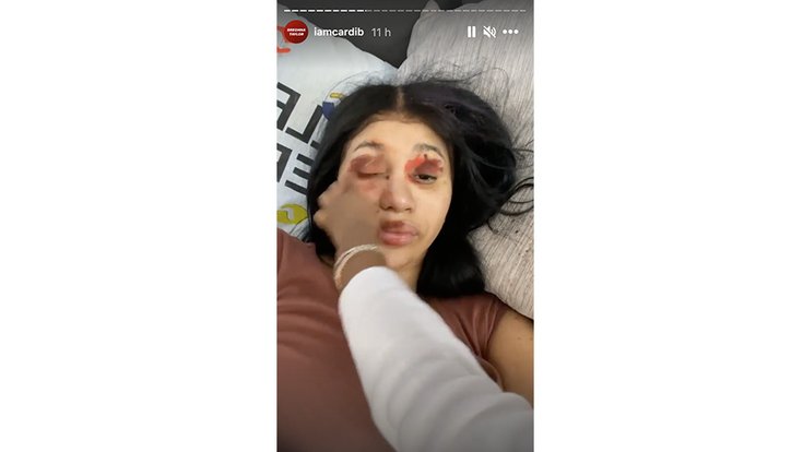 Story Instagram Cardi B