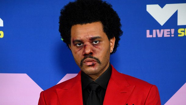 The Weeknd: pourquoi est-il toujours défiguré?