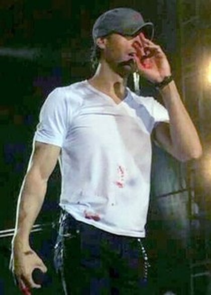 Enrique Iglesias blessé par un drone sur scène